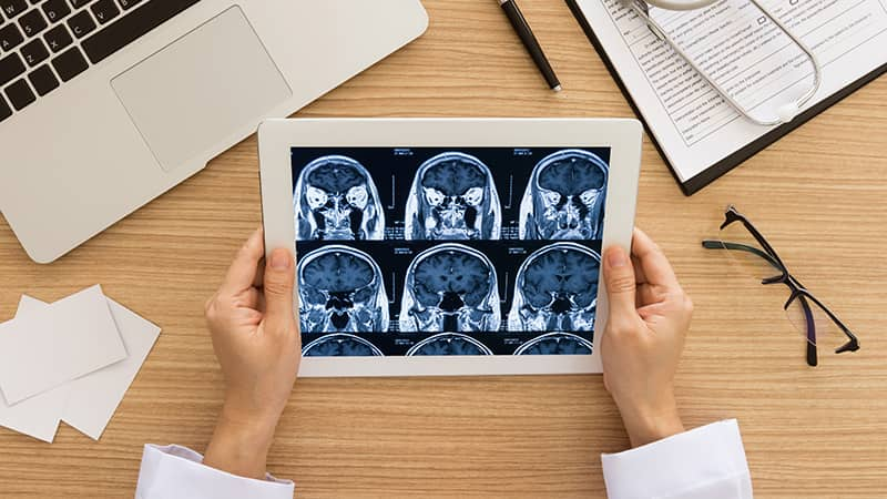 MRI และ CT Scan ไม่เหมาะกับใคร | ประกันโรคร้ายแรง | รู้ใจ