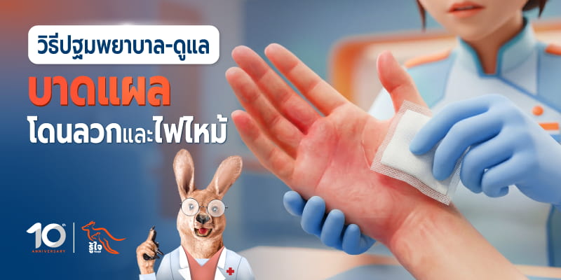 สาเหตุของบาดแผลไฟไหม้ การปฐมพยาบาล และการรักษา รู้ใจประกันภัย